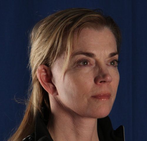 After — facelift and neck lift result, front view