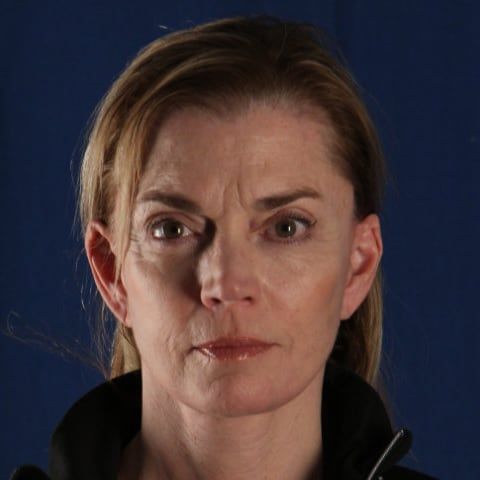 After — facelift and neck lift result, three-quarter view