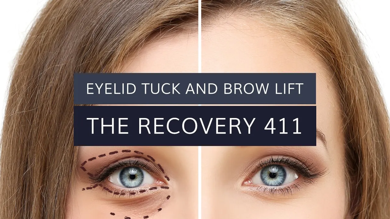Eyelid Tuck and Brow Lift: The Recovery 411