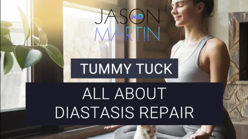 Rectus Diastasis Repair: A Key Part of Tummy Tucks