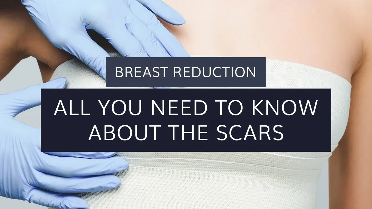 Breast Reduction: All You Need to Know About Scars