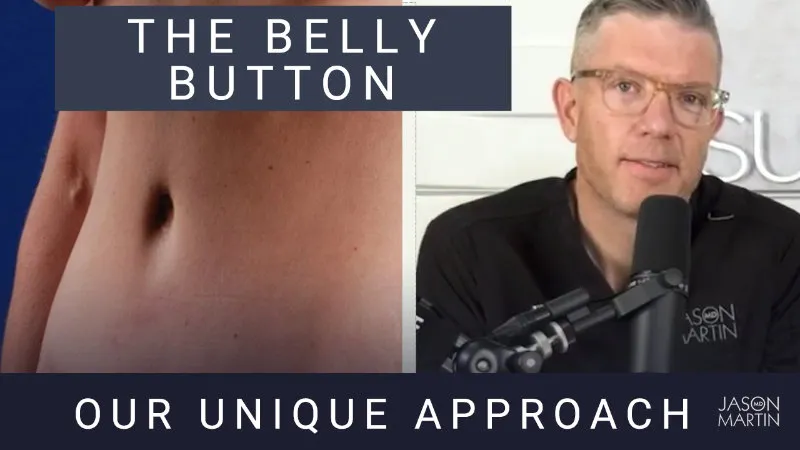 Making Natural-Looking Belly Buttons With a Tummy Tuck