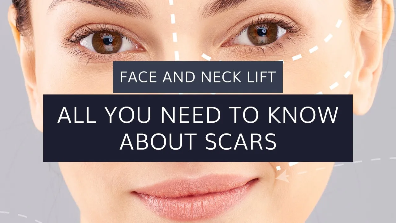 Face and Neck Lift: Everything You Need to Know About Scars