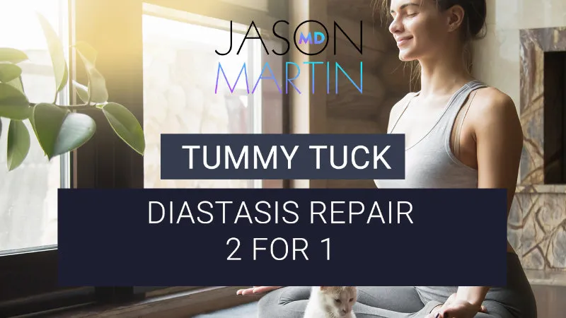 The Secret Perk of Rectus Diastasis Repair: A More Defined Waist