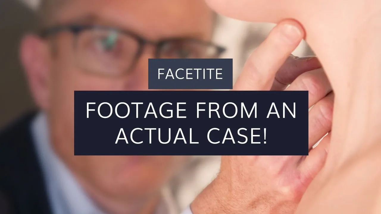FaceTite: Footage From an Actual Case