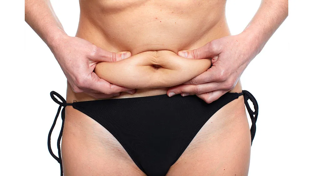 Choosing Between Liposuction and Tummy Tuck Surgery