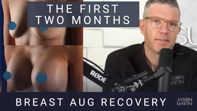 Breast Augmentation Recovery: The First Two Months