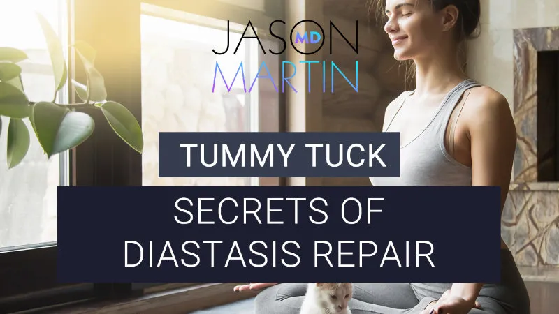 The Secrets of Rectus Diastasis Repair