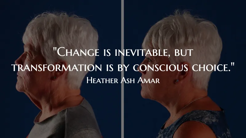 Neck Lift Transformation