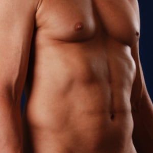 After — Tummy tuck before and after — waistline shape